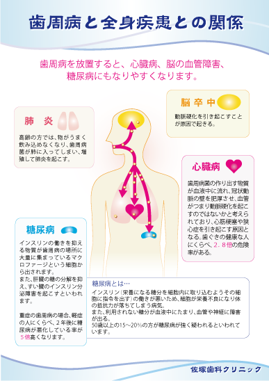 歯周病と全身疾患との関係